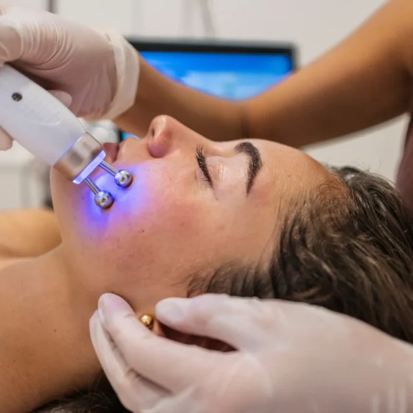 Rejuvenecimiento facial con tecnología