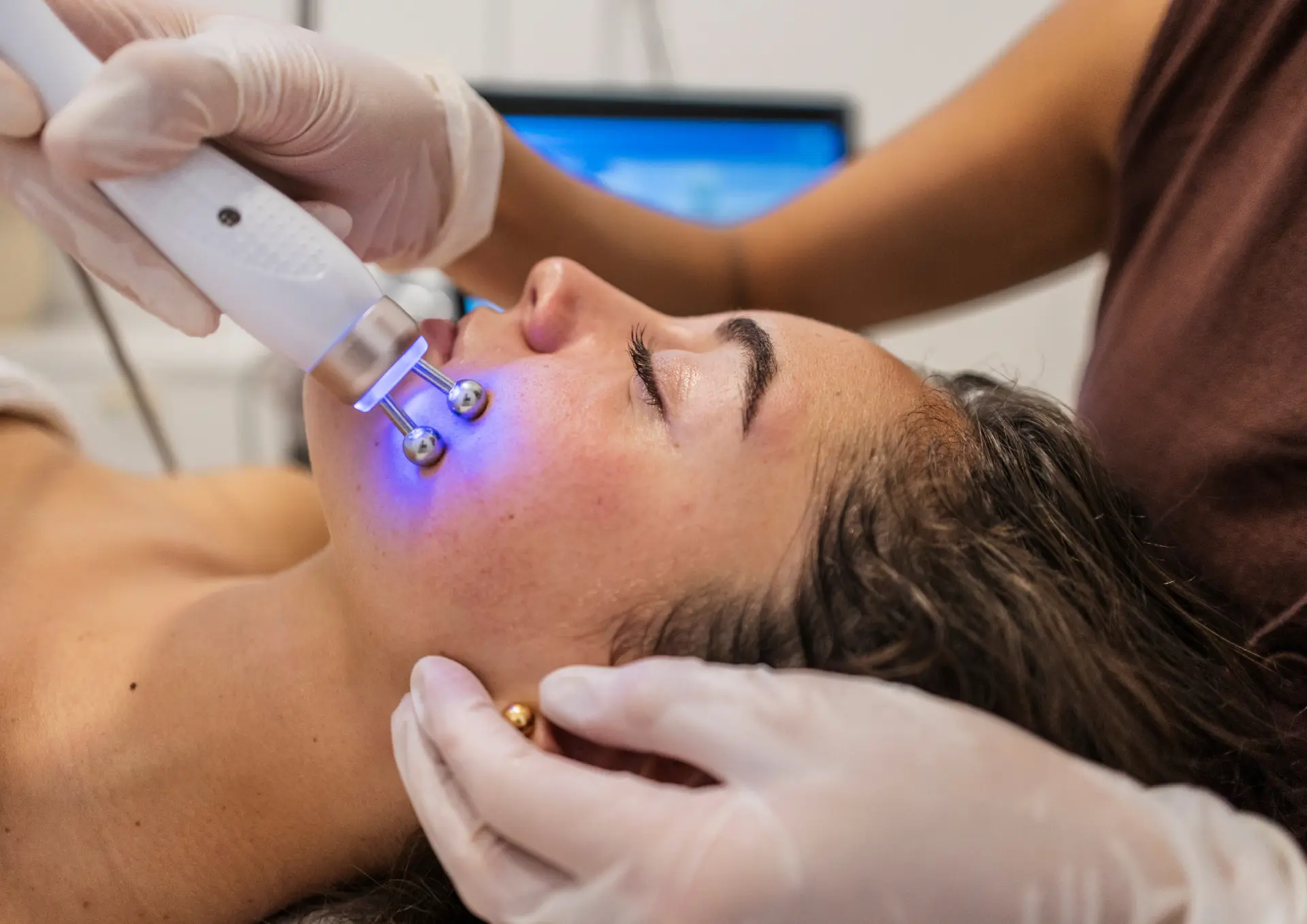 Rejuvenecimiento facial con tecnología Rejuvenecimiento facial con tecnología - Imagen 1